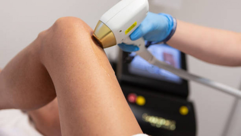 Discover the Future of Smooth Skin with Laser Hair Removal in Abu Dhabi