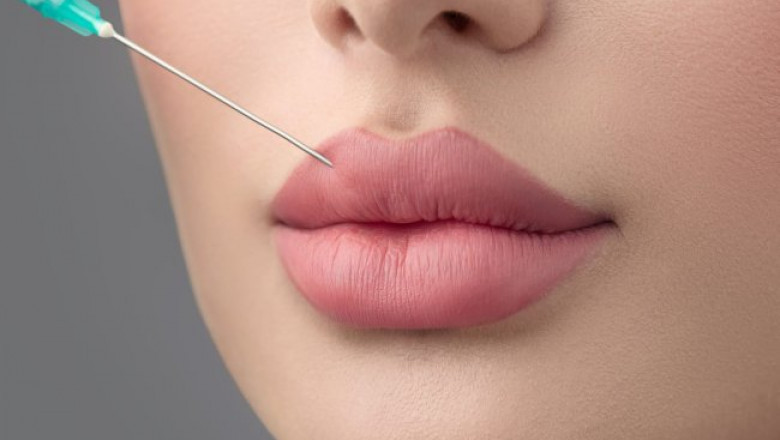 What Makes the Russian Lip Fillers Treatment in Dubai So Popular?