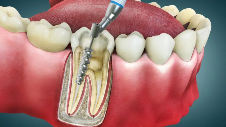 Dental Health During Pregnancy:Tips for Every Trimester