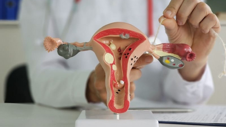 What Gynecological Services Are Considered Preventive?