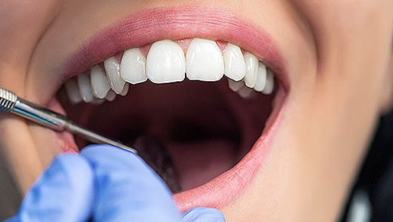 Smile Brighter with the Best Dentist in South Morang: Your Guide to Exceptional Dental Care