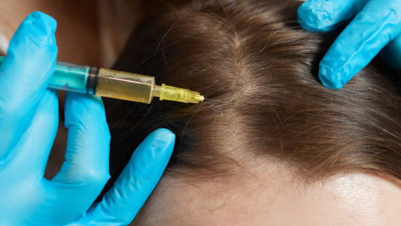 PRP vs. Botox, Which Is Better for Anti-Aging?